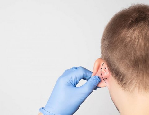 Chirurgie des oreilles décollées à Lyon