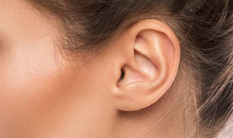 Réparation du lobe de l'oreille soit le lobe bifide à Lyon 